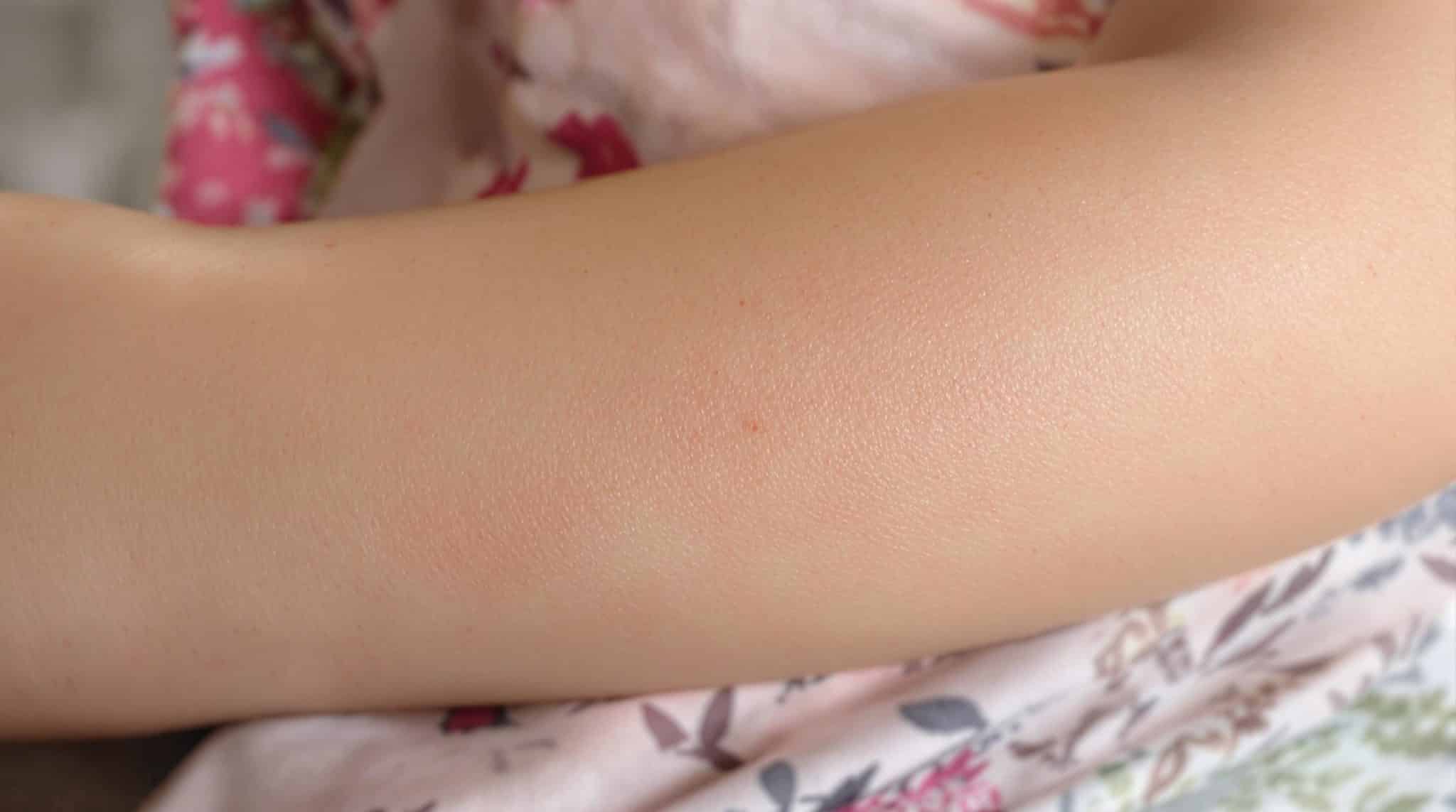 Skin with small red dots