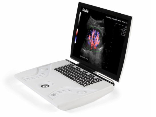 Échographe portable : révolutionner le diagnostic au chevet 1 echographe portable